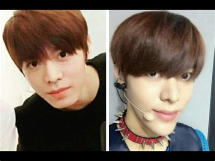 Yuta Nakamoto Plastic Surgery | Before And After Photos